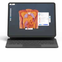 laptop computer featuring interactive 3d medical imaging software platform VoxScan