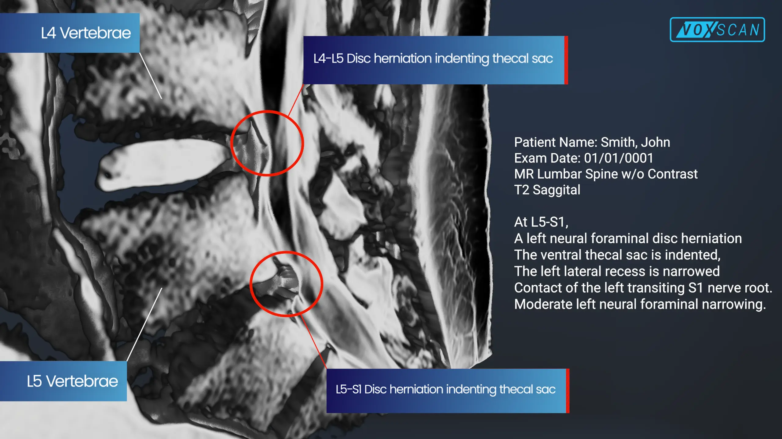 Update Demand Letter