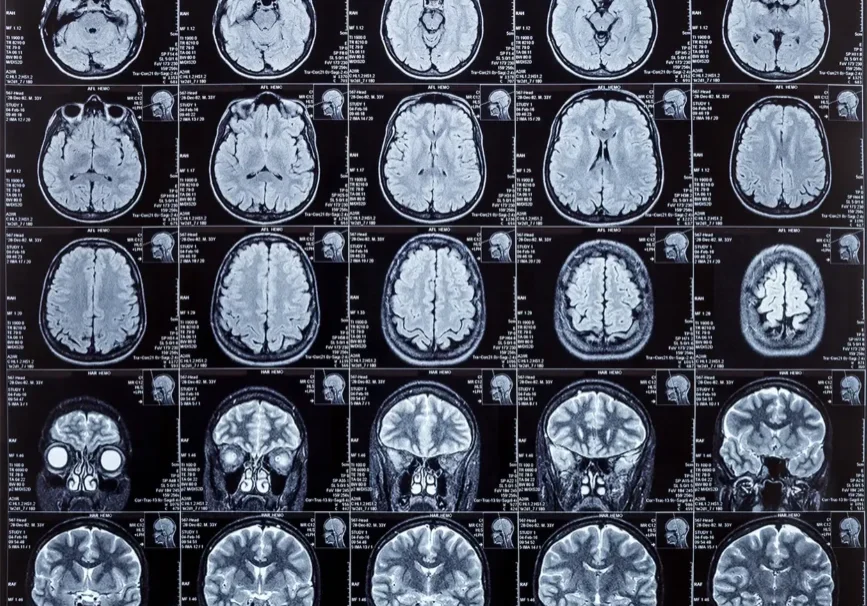 a flat full screen mri scan of a brain in 2D vs 3D interactive medical imaging