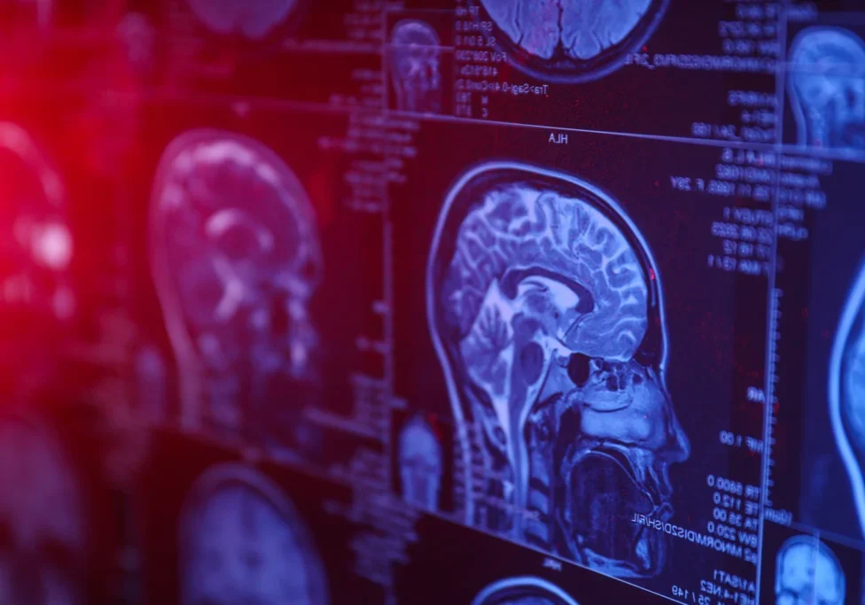 a close up of a mri scan of a brain in 2D vs 3D interactive medical imaging